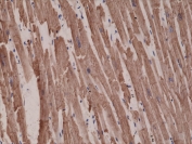 IHC testing of FFPE human heart tissue with recombinant ACTC1 antibody at 1:1000.