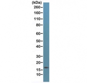 Western blot testing of human HeLa cell lysate with recombinant p16INK4a antibody at 1:500. Predicted molecular weight ~16 kDa.