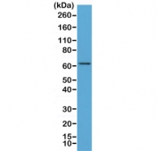 Western blot of human MCF7 cell lysate using recombinant p65 antibody at 1:500. Expected molecular weight ~65 kDa.