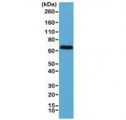 Western blot of human brain lysate using recombinant Neurofilament antibody at 1:2500. Predicted molecular weight: 62-68 kDa.