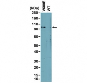 Western blot analysis of cell lysates prepared from cell lines expressing endogenous mutant (V600E) BRAF or wild type (WT) protein with recombinant BRAF V600E antibody.