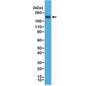 Western blot testing of human Jurkat cell lysate using recombinant CD45 antibody at a 1:2000 dilution. Expected molecular weight: 147-220 kDa depending on glycosylation level.