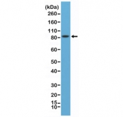 Western blot testing of mouse brain lysate with recombinant PSD95 antibody at 1:8000 dilution. Predicted molecular weight ~80 kDa but often observed at 90~95 kDa.
