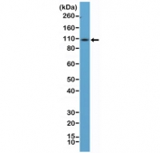 Western blot testing of mouse spleen tissue lysate using recombinant CD34 antibody at 1:100 dilution. Observed molecular weight: 41~110 kDa depending on level of glycosylation.