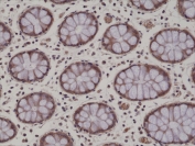 IHC testing of formalin fixed and paraffin embedded human colon tissue with recombinant AMPK alpha 1 antibody at 1:200 dilution. HIER: steam section in pH6 citrate buffer for 20 min and allow to cool prior to staining.