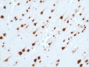 IHC testing of formalin fixed and paraffin embedded human brain tissue with recombinant NeuN antibody at 1:1000 dilution. HIER: steam section in pH6 citrate buffer for 20 min and allow to cool prior to staining.