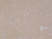 IHC testing of formalin fixed and paraffin embedded human brain tissue with recombinant CD56 antibody at 1:1000 dilution. HIER: steam section in pH6 citrate buffer for 20 min and allow to cool prior to staining.