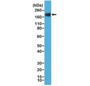 Western blot testing of human MCF7 cell lysate with recombinant CEA antibody at 1:000. Expected molecular weight: 80~200 kDa depending on glycosylation level.