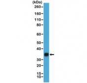 Western blot testing of hCG protein purified from human urine using recombinant HCGb antibody at 1:20,000. Predicted molecular weight ~18 kDa (beta subunit) and ~26 kDa (hCG complex), but can be observed at up to ~40 kDa due to glycosylation.
