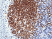 IHC staining of FFPE human tonsil tissue with recombinant CD19 antibody at 1:1000.