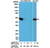 Western blot testing of a cell lysate mixture of untransfected 293T and 293T transfected with a DNA construct encoding the Akt E17K mutant, using recombinant AKT E17K Mutant antibody (RM336) or AKT antibody (clone RM252).