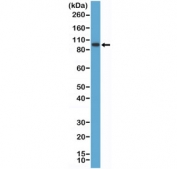 Western blot testing of human K562 cell lysate with recombinant SATB2 antibody at 1:1000 dilution. Predicted molecular weight ~83 kDa.