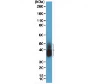 Western blot testing of human lung tissue with recombinant Napsin-A antibody at 1:2000 dilution. Expected molecular weight: 38-45 kDa depending on glycosylation level.