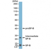 Western blot testing of human lung tissue lysate with recombinant SP-B antibody at 1:1000.