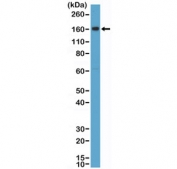 Western blot testing of human placental tissue lysate with recombinant CD163 antibody at 1:2000 dilution. Predicted molecular weight ~130 kDa but may be observed at higher molecular weights due to glycosylation.