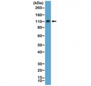 Western blot testing of human HeLa cell lysate with recombinant MSH2 antibody at 1:1000 dilution. Expected molecular weight ~105 kDa.