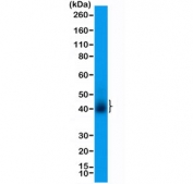 Western blot testing of human T-cell lysate with recombinant CD28 antibody at 1:200 dilution. Expected molecular weight depending on level of glycosylation: ~25-44 kDa (monomer), ~50-90 kDa (dimer).