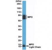 Western blot testing of human HL60 cell lysate with recombinant Myeloperoxidase antibody at 1:200 dilution. Expected molecular weight: ~13 kDa (light/beta chain), ~73 kDa (heavy/alpha chain + light/beta chain), ~150 kDa (mature form). The protein may be observed at higher molecular weights due to glycosylation.