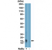 Western blot testing of acid extracts of HeLa cells, treated (+) or untreated (-) with sodium butyrate, using H2BK11ac antibody at 0.002 ug/ml.