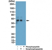Western blot of mouse brain tissue lysate using recombinant Phosphorylated Tau antibody at a 1:1000 dilution. The phospho-specificity of the antibody was verified by peptide blocking using a phosphopeptide or non-phosphopeptide targeting residue Ser396. The expected molecular weight of phosphorylated Tau (Ser198) is approximately 45-70 kDa, corresponding to the major Tau isoforms, and lower molecular weight bands around ~35 kDa may represent truncated Tau fragments commonly observed in brain tissue.