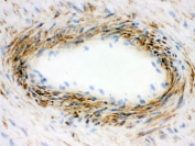 IHC-F testing of frozen human placenta with Actin antibody. 