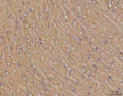 IHC staining of FFPE rat brain tissue with Calcineurin A antibody. HIER: boil tissue sections in pH8 EDTA for 20 min and allow to cool before testing.