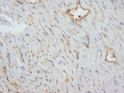 IHC-P: Desmin antibody testing of rat heart tissue