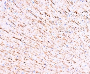 IHC-P: MAP1 antibody testing of rat brain tissue. HIER: steamed with pH6 citrate buffer, HRP-staining.