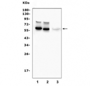 Western blot testing of 1) rat brain, 2) mouse brain and 3) human U-87 MG cell lysate with Tyrosine Hydroxylase antibody. Predicted molecular weight ~59 kDa.