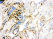 IHC testing of frozen human placenta tissue with Vinculin antibody.