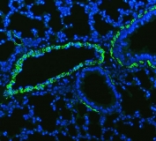 Immunofluorescent staining of FFPE rat lung tissue with ACTA2 antibody (green) and DAPI nuclear stain (blue). HIER: steam section in pH8 EDTA buffer for 20 min.