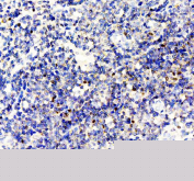 IHC staining of FFPE human tonsil tissue with FOXP3 antibody, HRP-labeled secondary and DAB substrate. HIER: boil tissue sections in pH8 EDTA for 20 min and allow to cool before testing.