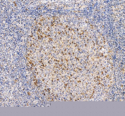 IHC staining of FFPE human tonsil tissue with PD1 antibody. HIER: boil tissue sections in pH8 EDTA for 20 min and allow to cool before testing.