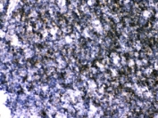 IHC-P: ATP2A3 antibody testing of rat thymus tissue