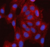 Immunofluorescent staining of FFPE human U-2 OS cells with SSH3BP1 antibody (red) and DAPI nuclear stain (blue). HIER: steam section in pH6 citrate buffer for 20 min.