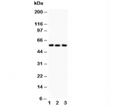 Western blot testing of Alkaline Phosphatase antibody and Lane 1:  human placenta;  2: HT1080;  3: Jurkat.  Predicted molecular weight ~57 kDa, but can be observed at up to ~75 kDa due to glycosylation.