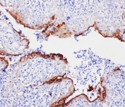 IHC-P: Annexin A1 antibody testing of human tonsil tissue. HIER: steam section in pH6 citrate buffer for 20 min.