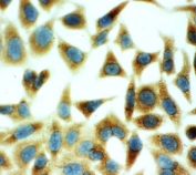 ICC testing of HeLa cells