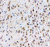 IHC staining of FFPE mouse brain tissue with Lamin B1 antibody. HIER: boil tissue sections in pH8 EDTA for 20 min and allow to cool before testing.
