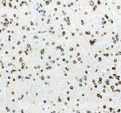 IHC staining of FFPE rat brain tissue with Lamin B1 antibody. HIER: boil tissue sections in pH8 EDTA for 20 min and allow to cool before testing.