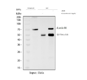 Immunoprecipitation of Lamin B1 protein from 500ug of human HeLa whole cell lysate with 2ug of Lamin B1 antibody.