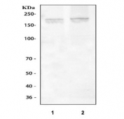 Western blot testing of 1) rat brain and 2) mouse brain tissue lysate with NMDAR2A antibody. Predicted molecular weight ~165 kDa.