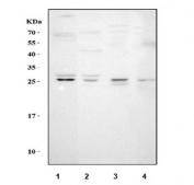 Western blot testing of 1) human HeLa, 2) human MCF7, 3) rat kidney and 4) mouse kidney tissue lysate with VEGF antibody. Expected molecular weight 19~22 kDa (monomer) and 38~44 kDa (dimer). Banding may appear larger than predicted due to glycosylation.