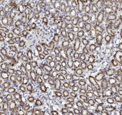 IHC staining of FFPE rat kidney with Cytochrome C antibody. HIER: steam section in pH6 citrate buffer for 20 min.