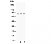 Western blot testing of CD18 antibody and Lane 1:  HeLa;  2: Jurkat;  3: HT1080; Predicted/Observed molecular weight: 85~95KD depending on glycosylation level.
