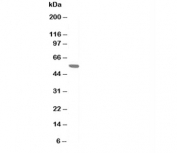 Western blot testing of AChR antibody and rat skeletal muscle tissue lysate