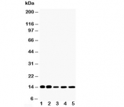 Western blot testing of FABP1 antibody and Lane 1:  rat liver;  2: rat kidney;  3: HeLa;  4: (mouse) Neuro-2a;  5: (human) SMMC-7721 cell lysate. Predicted molecular weight: ~14 kDa.