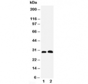 Western blot testing of Aquaporin 5 antibody and Lane 1:  rat lung;  2: rat testis tissue lysate. Predicted molecular weight ~28 kDa.