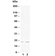 Western blot testing of 1) human HeLa and 2) rat PC-12 cell lysate with Bcl-XS antibody. Predicted/observed molecular weight: ~19 kDa.