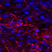 Immunofluorescent staining of spinal cord tissue with GFAP antibody (red) and DAPI nuclear stain (blue). HIER: steam section in pH8 EDTA buffer for 20 min and allow to cool prior to staining.
